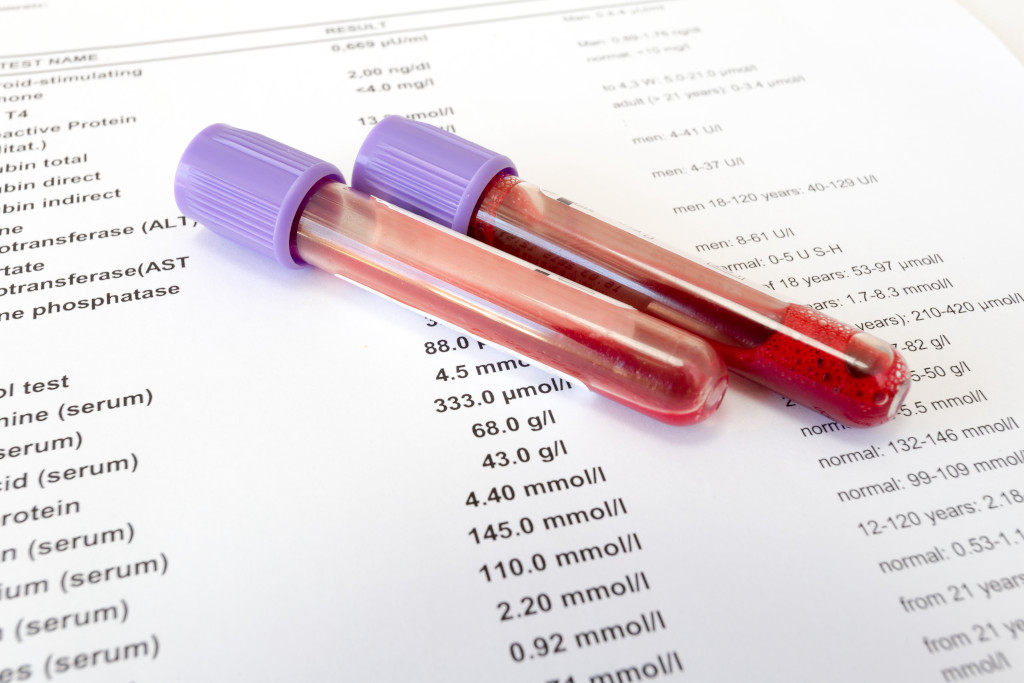 Photo of two glass test tubes with purple caps and filled with blood on white paper
that contain various medical information such as test types and quantities.